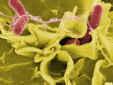 Salmonella bakterierne angriber mave-tarmkanalen. I alvorligere tilfælde kan den gå over i lymfesystemet og i blodbanen