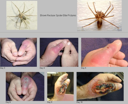 Spanien i Dag | - Pas på edderkopper
